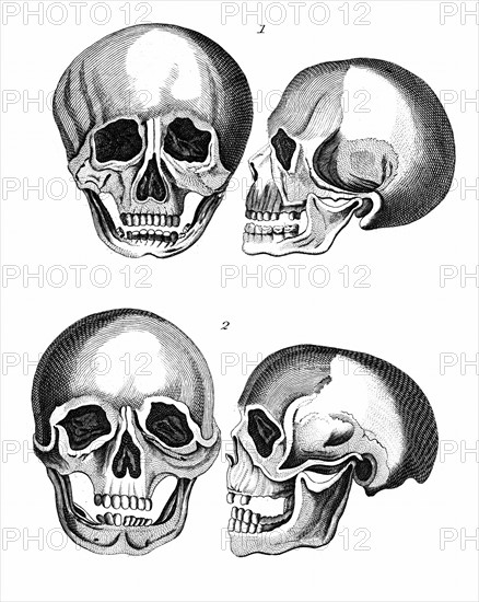 Germanic skull