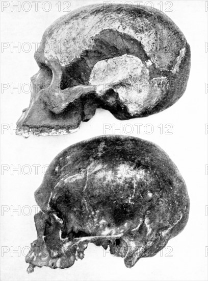 Skull of Piltdown man