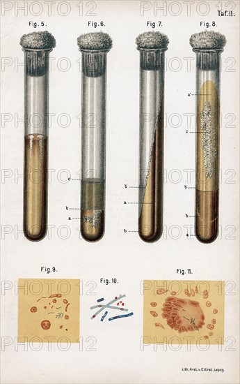 5:Pneumonia culture