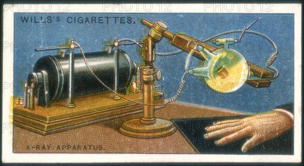 X-ray apparatus powered by a Ruhmkorff coil being used to take an X-ray of a hand