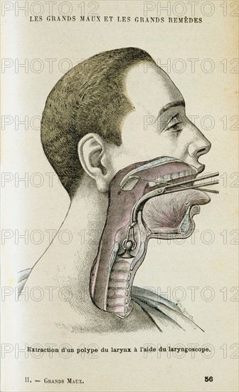 Using a laryngoscope to aid a surgeon