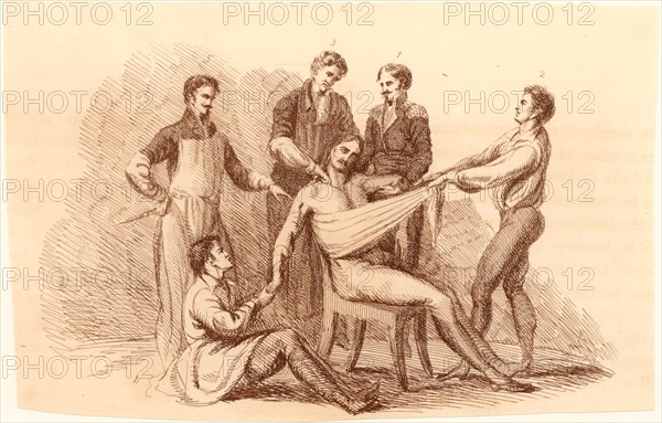 Surgeon and his assistants, before the introduction of anaesthetics
