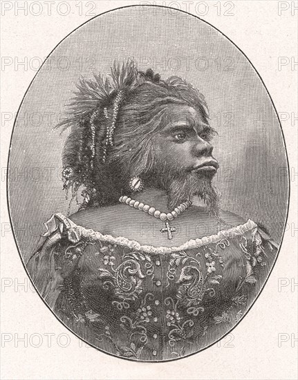 Julia Pastrana the Mexican bearded woman
