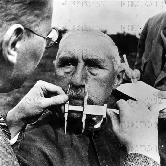A man having his nose measured during Aryan race determination tests under Nazi Germany's Nuremberg Laws that was applied to determine whether a person was considered a 'Jew'