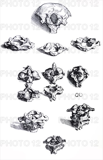 Plates from the First Book of the De Humani Corporis Fabrica by Vesalius