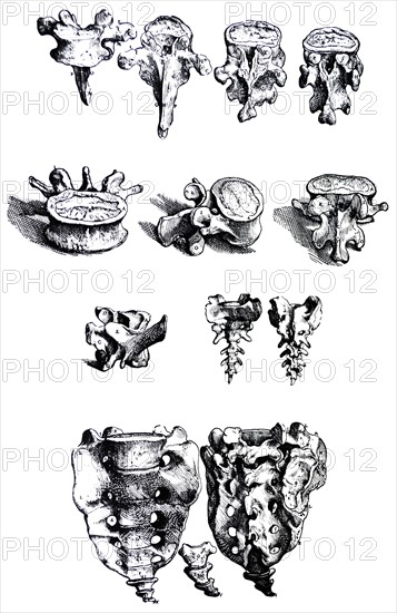 Plates from the First Book of the De Humani Corporis Fabrica by Vesalius