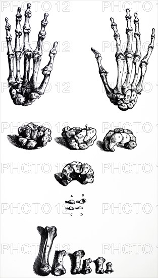 Plates from the First Book of the De Humani Corporis Fabrica by Vesalius