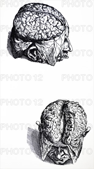 Plates from the Seventh Book of the De Humani Corporis Fabrica by Vesalius