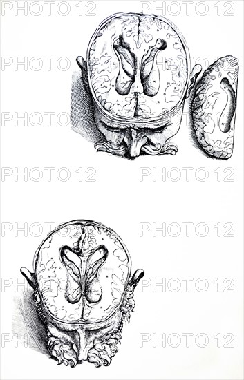 Plates from the Seventh Book of the De Humani Corporis Fabrica by Vesalius