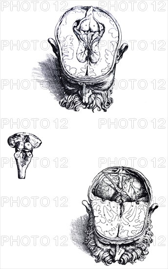 Plates from the Seventh Book of the De Humani Corporis Fabrica by Vesalius