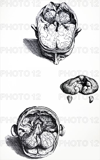 Plates from the Seventh Book of the De Humani Corporis Fabrica by Vesalius