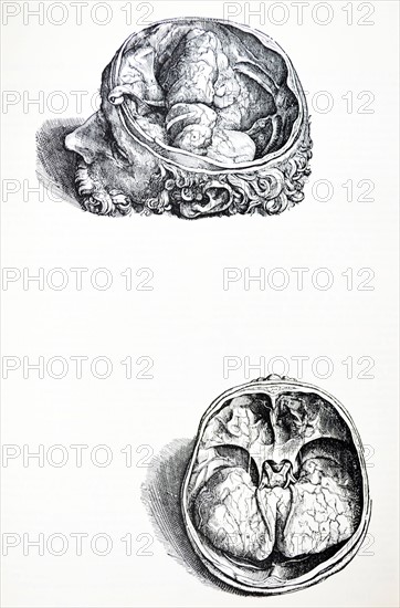 Plates from the Seventh Book of the De Humani Corporis Fabrica by Vesalius