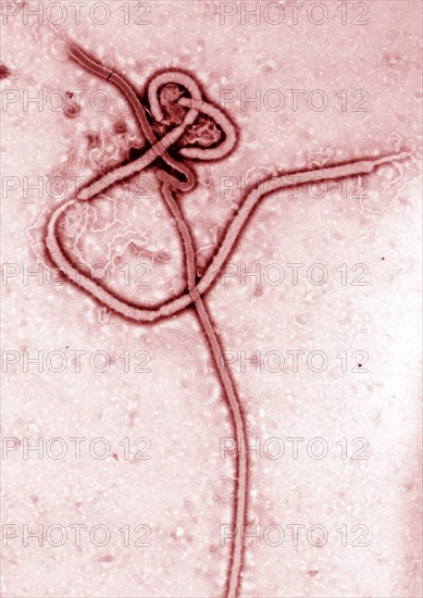 Transmission electron Micrograph of the Ebola Virus Hemorrhagic Fever RNA Virus