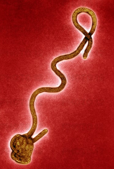 Transmission electron Micrograph of the Ebola Virus Hemorrhagic Fever RNA Virus