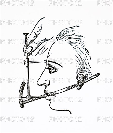 A clinometer used for measuring angles of the profile of a face