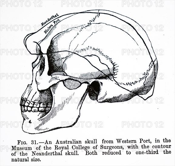 The comparison of human skulls