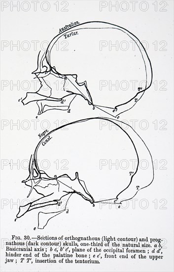 The comparison of human skulls