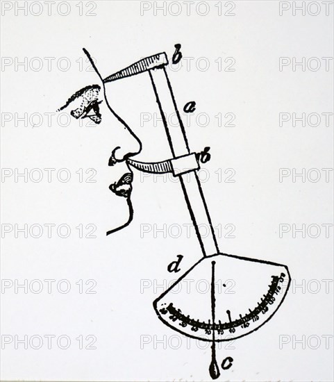 A clinometer used for measuring angles of the profile of a face