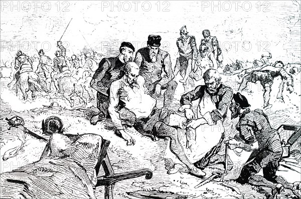 Ambroise Paré tying off arteries after amputation during the siege of Boulogne