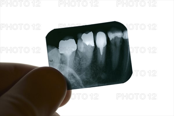 Dental x-ray being examined by a dentist