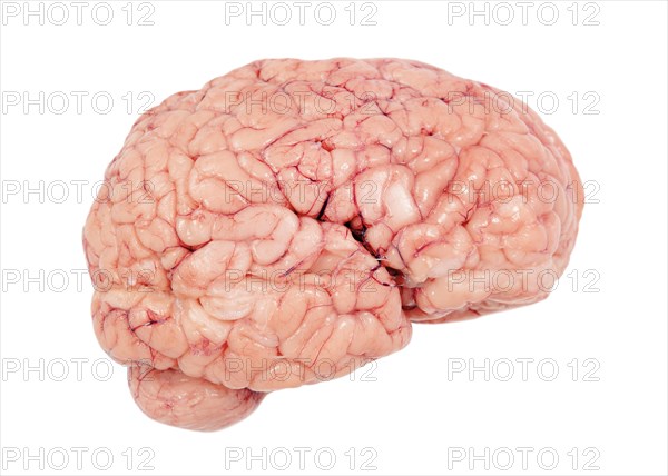 Human brain