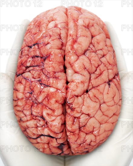 Human brain