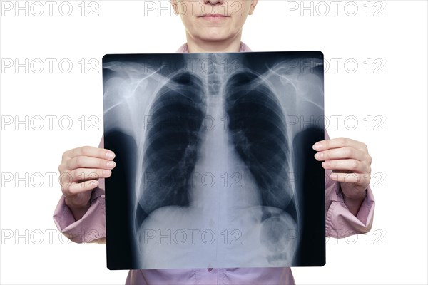 Woman holding a chest x-ray in front of her body