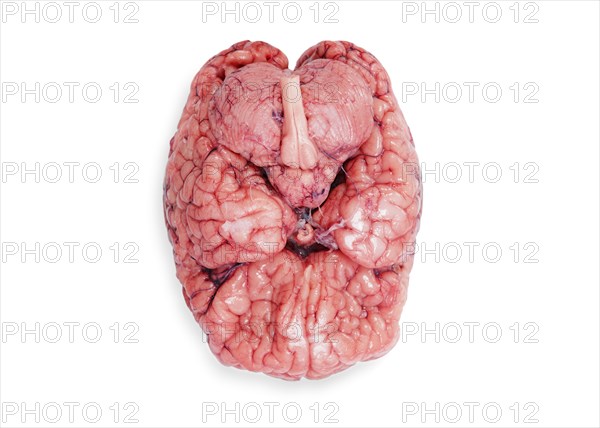 Human brain