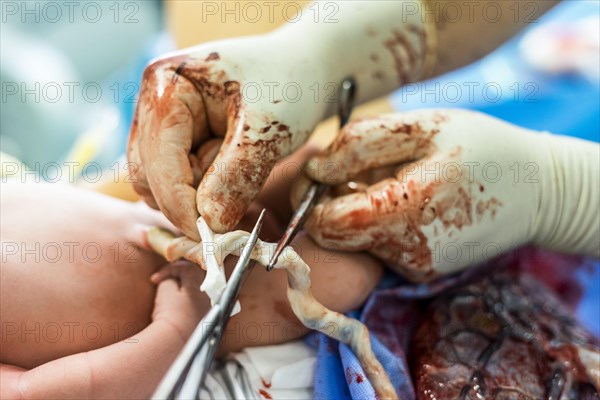 Father cuts the umbilical cord between a newborn baby and placenta