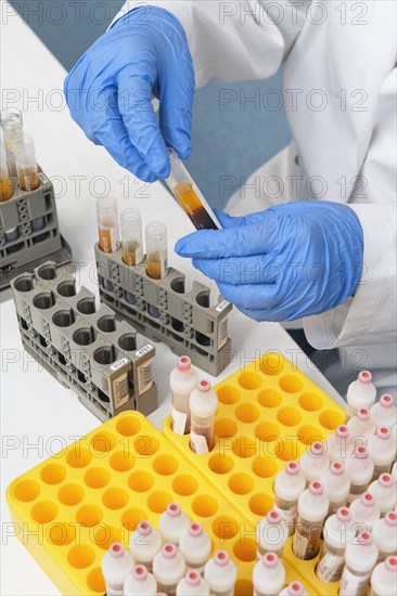 Preparation of blood samples for examination in the fully automatic machine for clinical chemistry and immunology