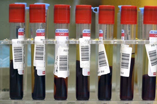 Blood samples in medical laboratory
