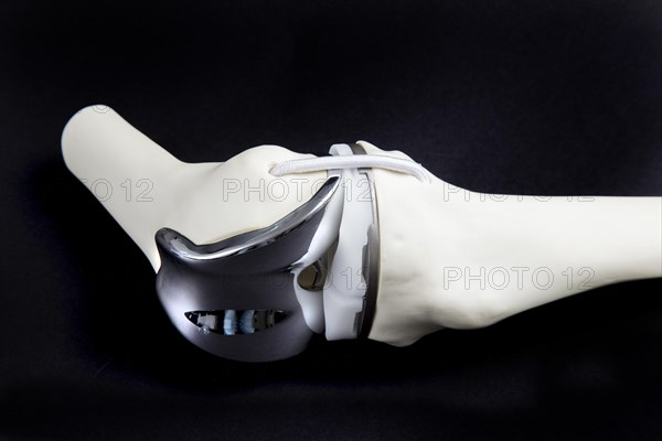 Knee prosthesis