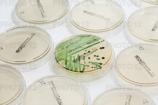 Microbiological diagnosis of MRSA bacteria