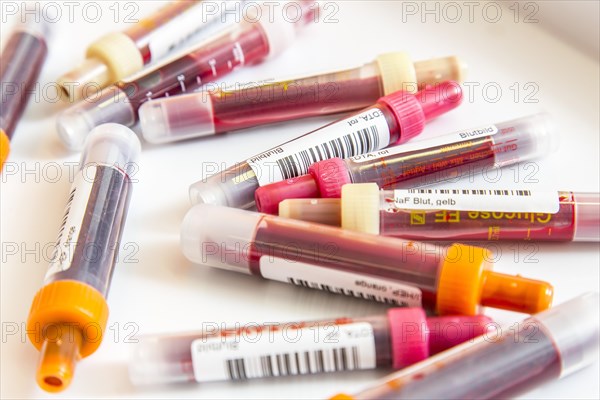 Blood samples