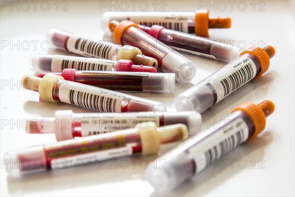 Blood samples