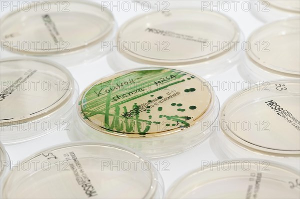 Microbiological diagnosis of MRSA bacteria