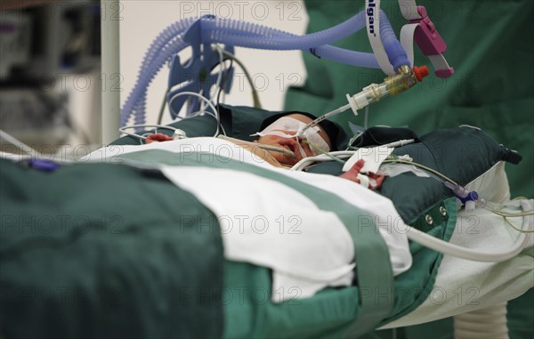 Surgery of a newborn