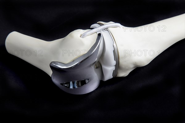 Knee prosthesis