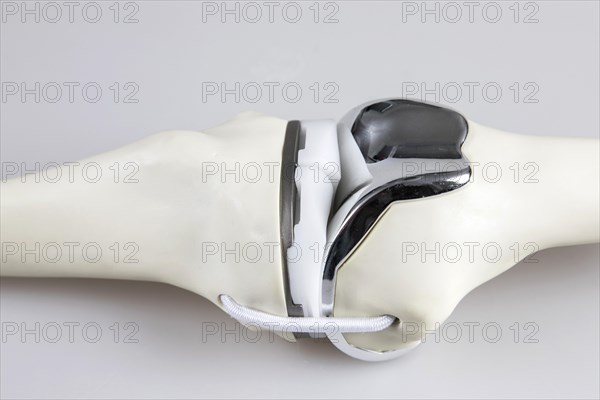 Knee prosthesis