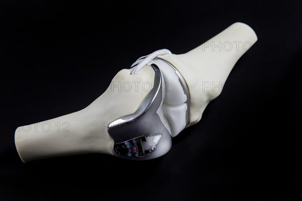 Knee prosthesis