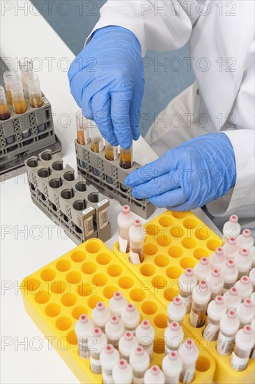 Preparation of blood samples for examination in the fully automatic machine for clinical chemistry and immunology