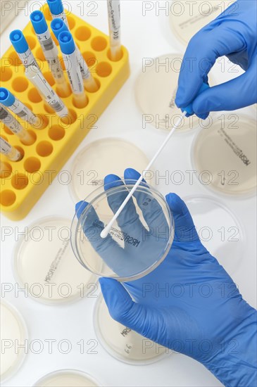 Smear from mucous membranes is cultivated in petri dishes