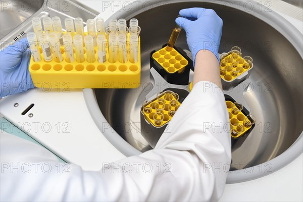 Centrifugation of urine