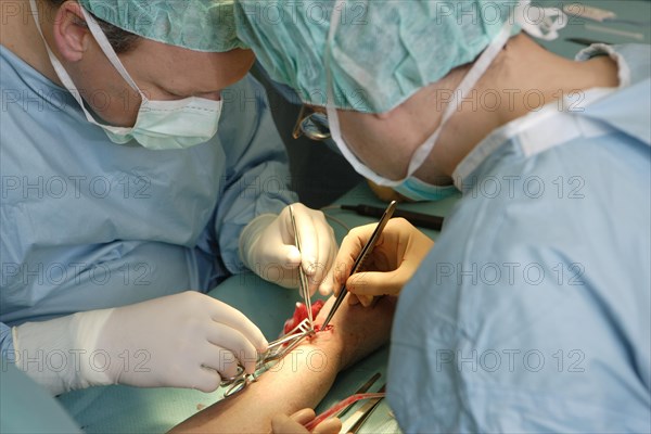 Vascular surgery