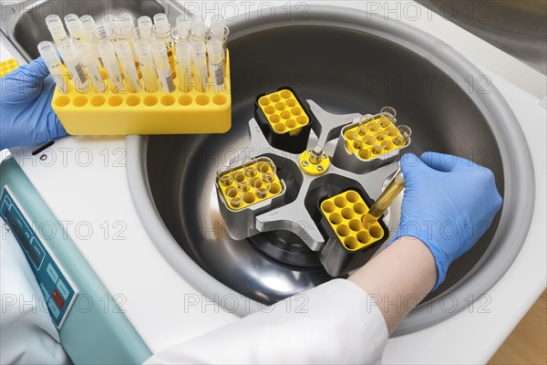 Centrifugation of urine