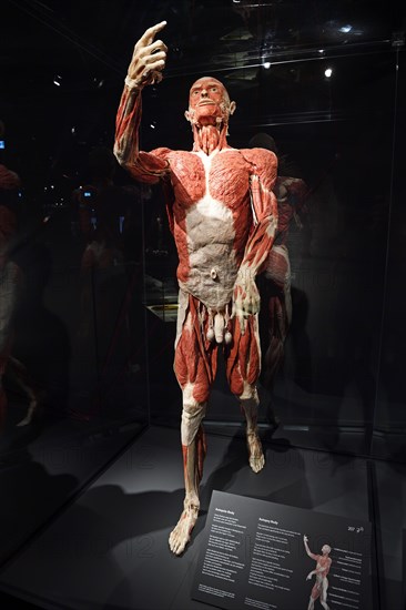 Plastinate