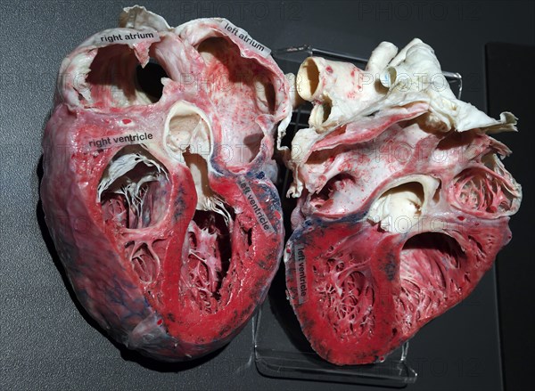 Plastinate