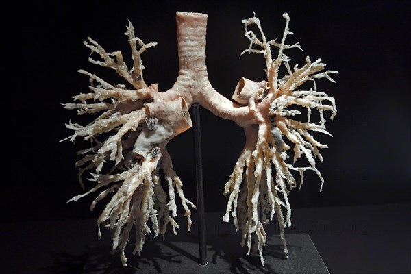 Plastinate