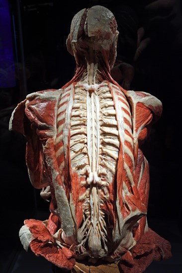 Plastinate