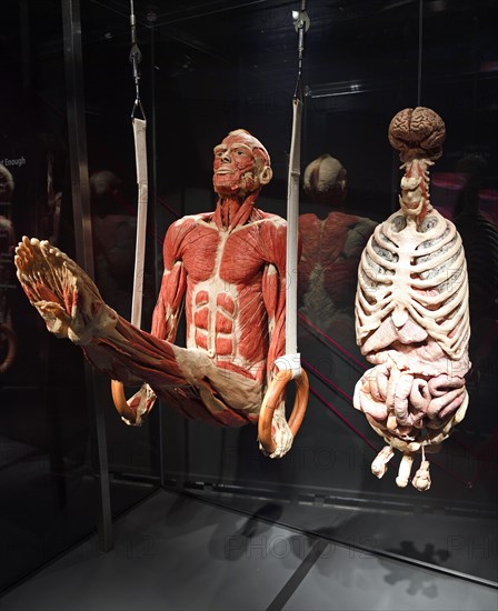 Plastinate